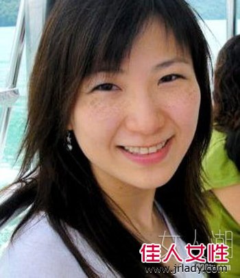 斑點女曬如何成功祛斑