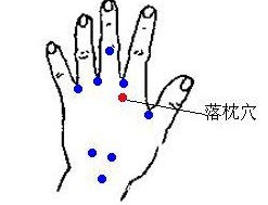 中醫穴位針灸治療冬季落枕